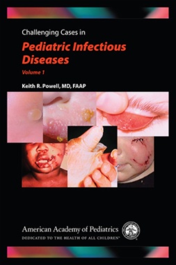 Challenging Cases in Pediatric Infectious Diseases